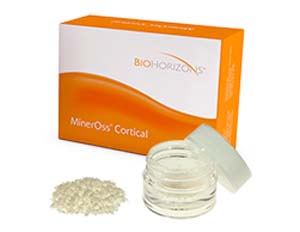 MinerOss FDBA Cortical 2.5cc